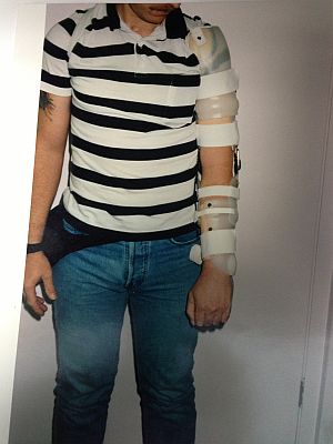 Brachial-Plexus-SEWHO