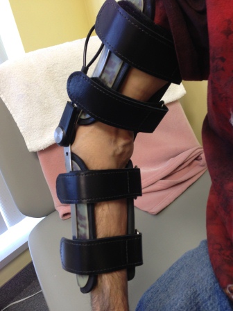 CustomElbowOrthosis1