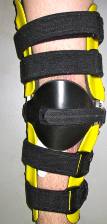 CustomKneeOrthosis