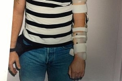 Brachial-Plexus-SEWHO